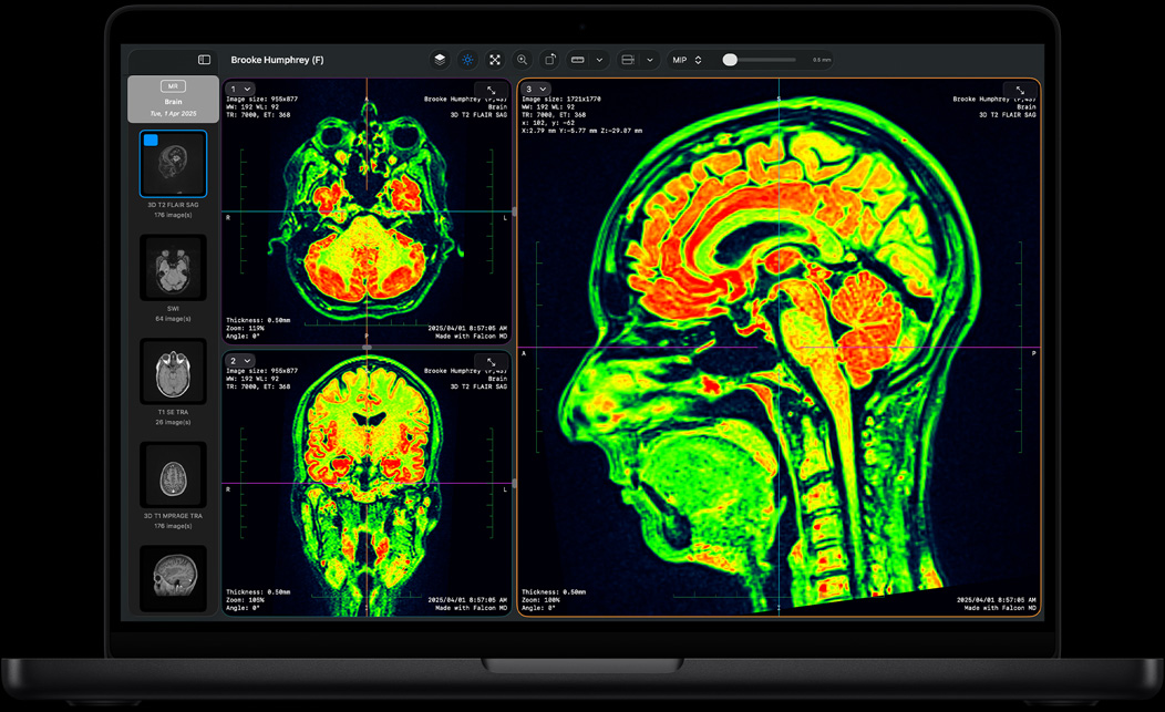 Schermata di MacBook Pro con Falcon MD